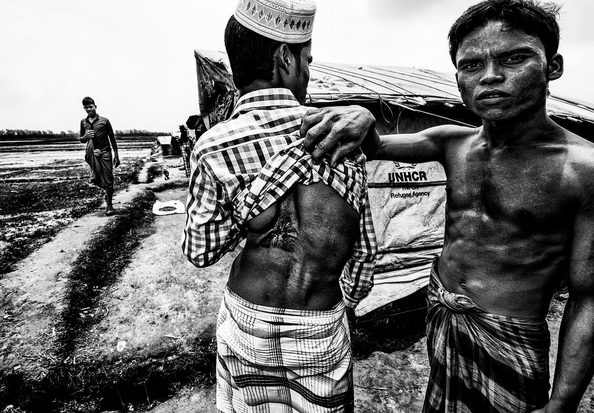 Rohingya refugee showing the impact of a bullet in his friend´s body - Bangladesh Poster och Canvastavla