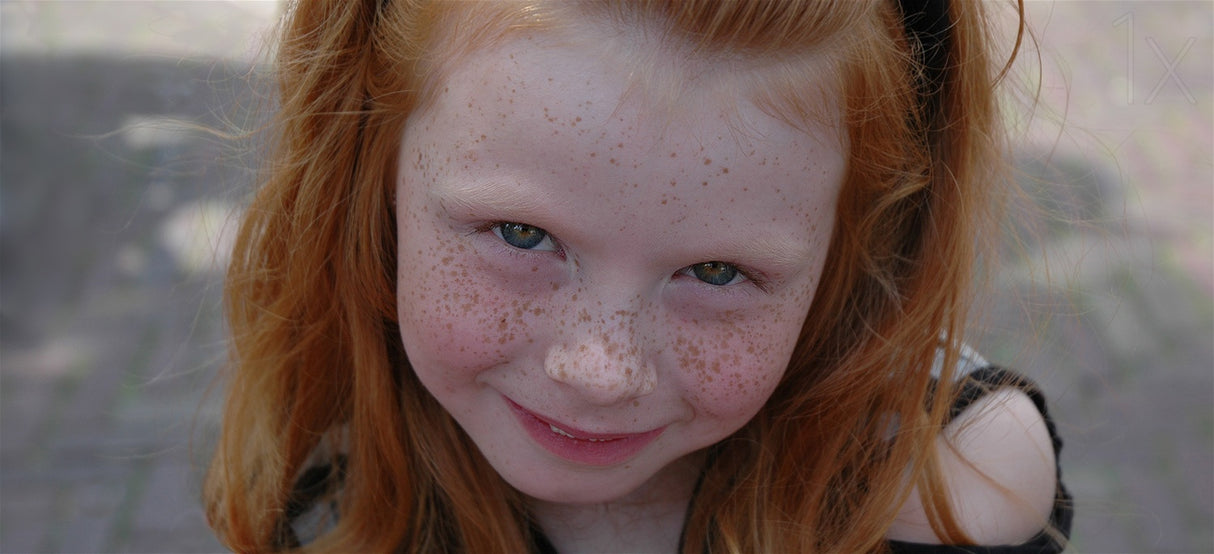 Freckled young lady Poster och Canvastavla