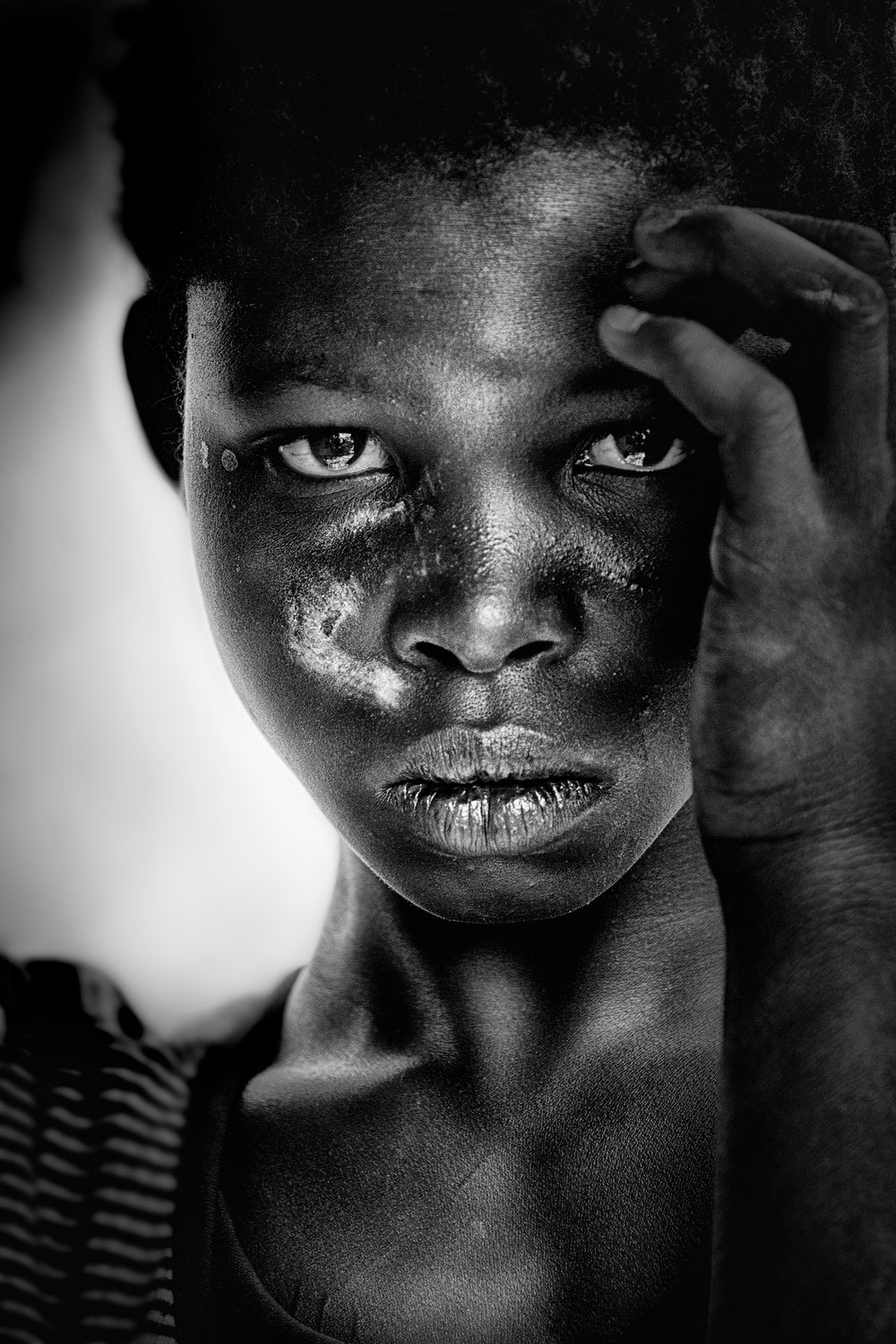 Scarred girl - Benin (Africa) Poster och Canvastavla