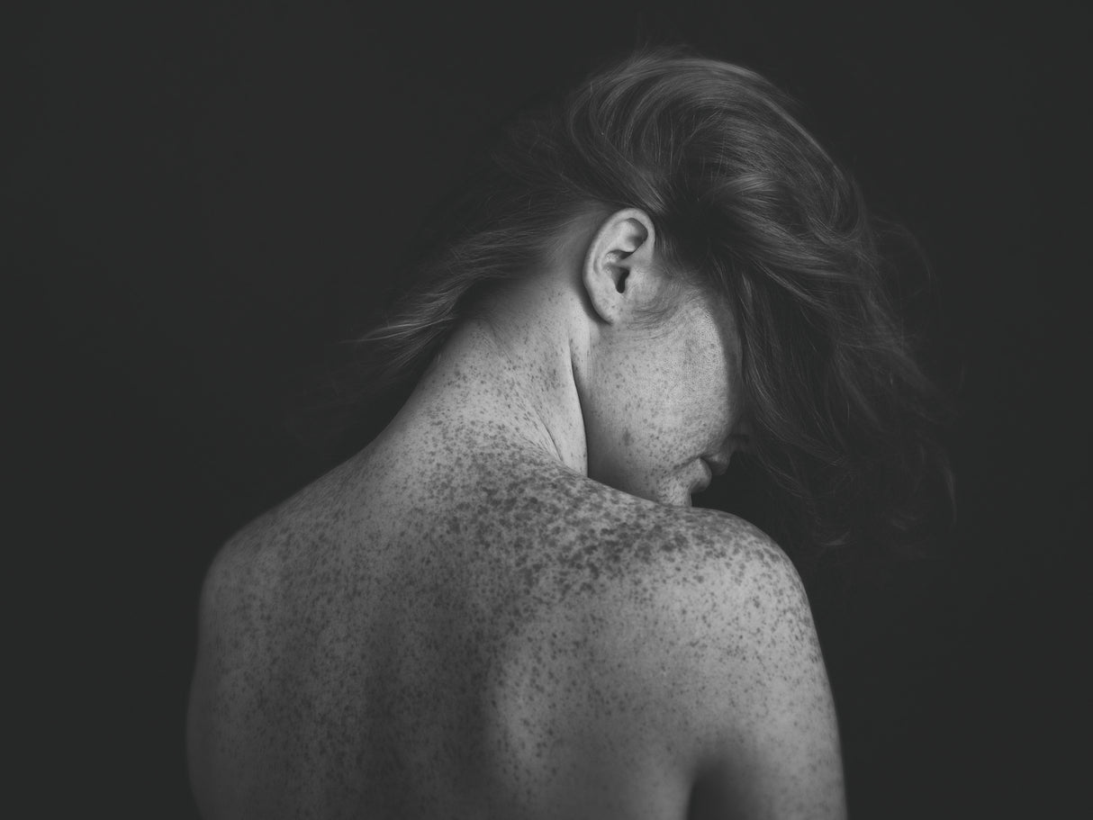 Freckles Poster och Canvastavla