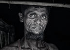 Rohingya refugee man - Bangladesh Poster och Canvastavla