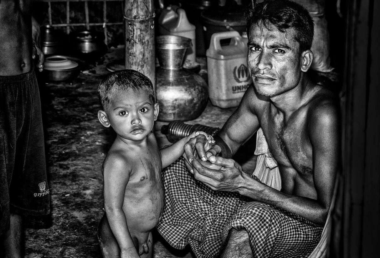 Rohingya refugee father and his son - Bangladesh Poster och Canvastavla