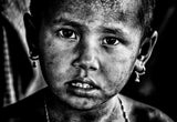Rohingya refugee girl - Bangladesh Poster och Canvastavla