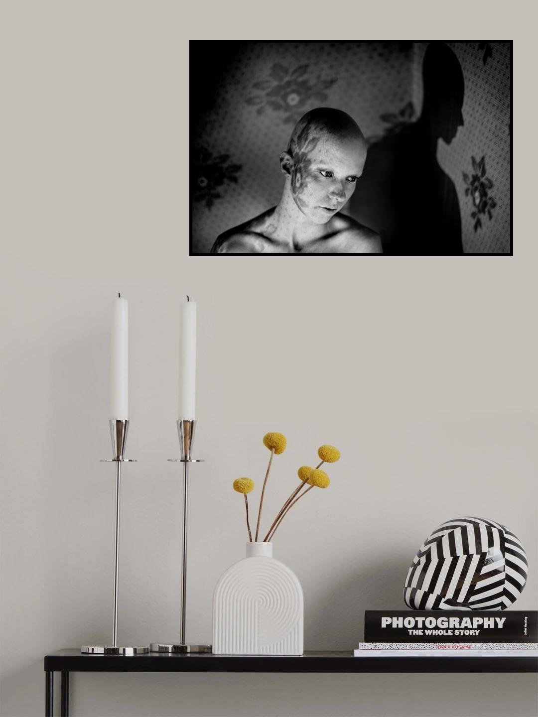 Alopecia Poster och Canvastavla